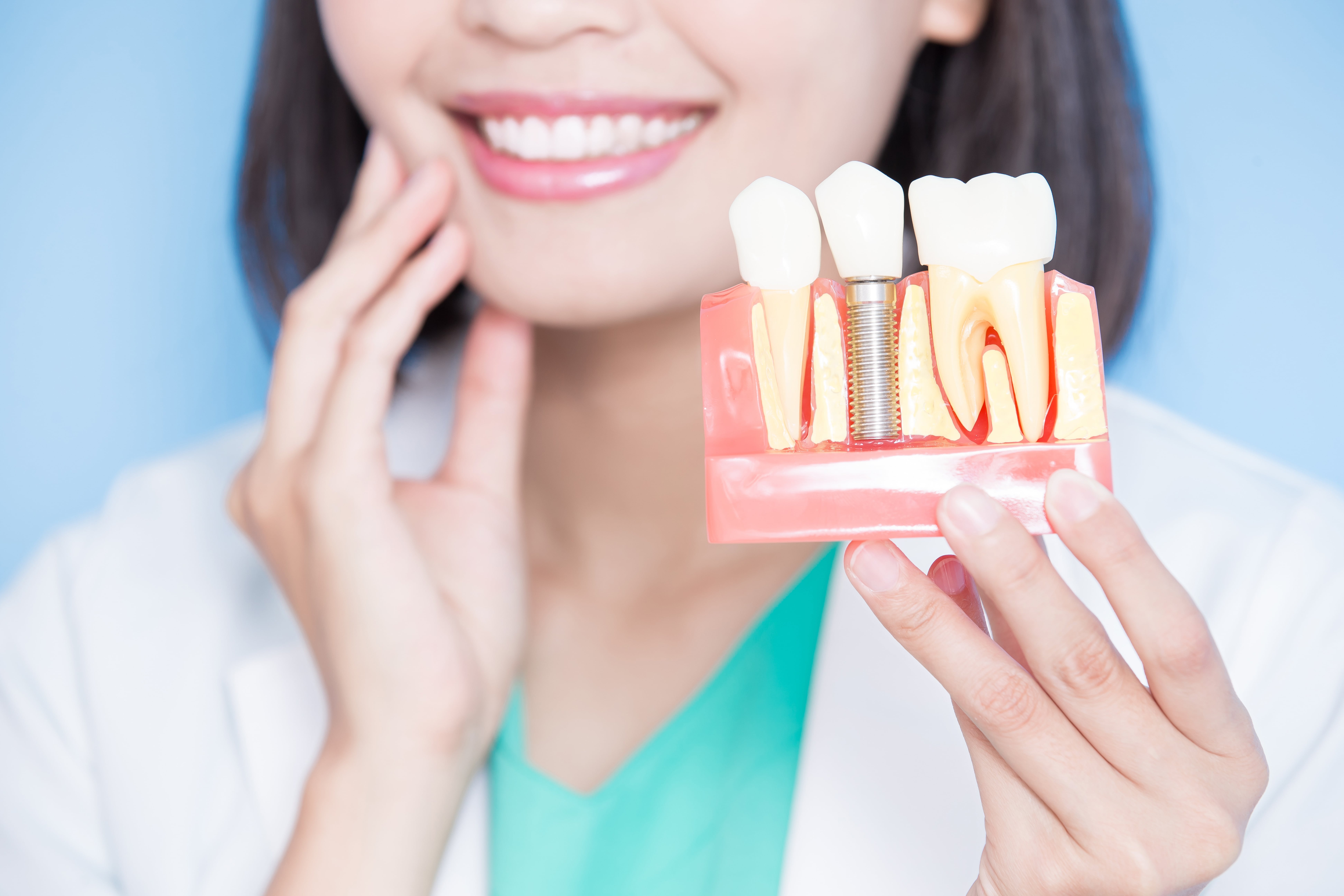 Dental Implants Fort Worth