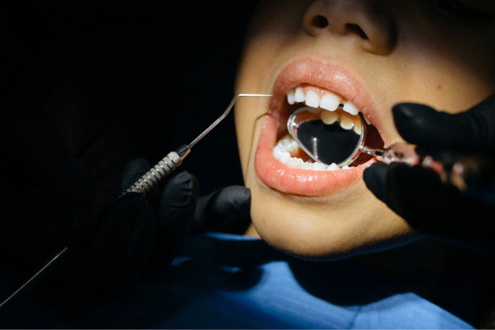 Porcelain Veneers vs Braces Which Is Better for Teeth Gaps? David J