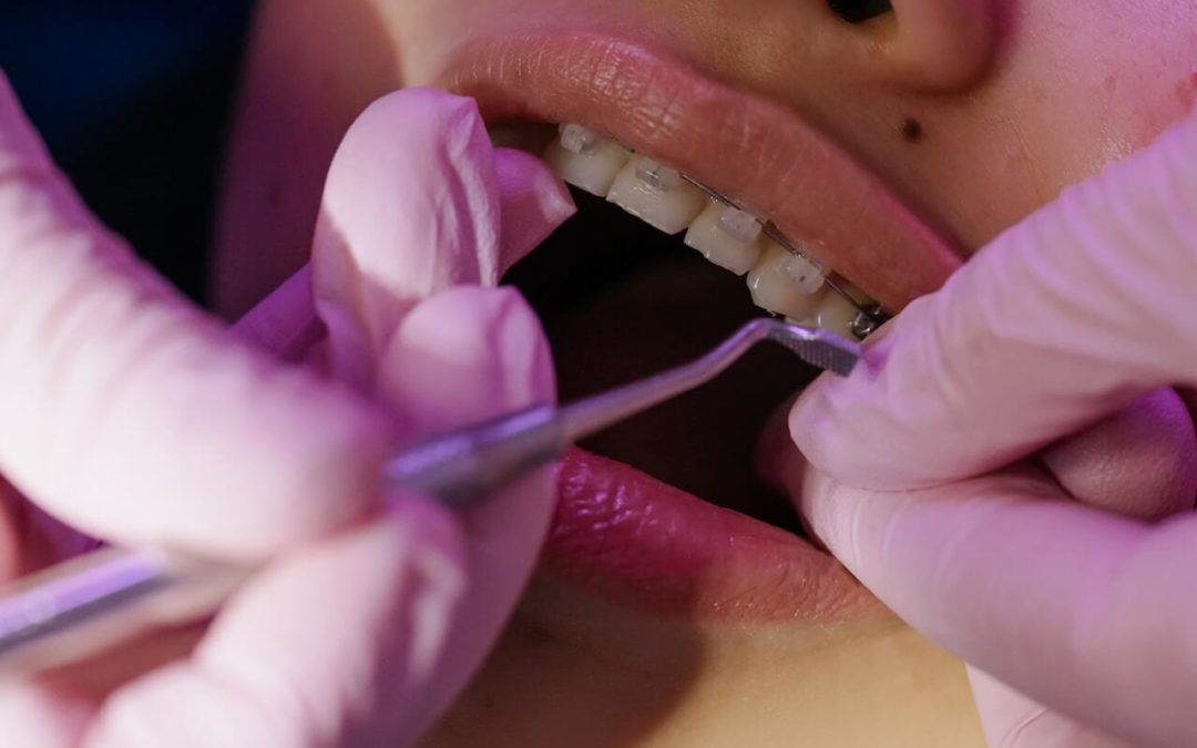 Cosmetic Dentist Service in Fort Worth