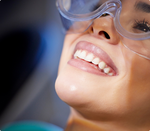 Smiling person wearing protective eyewear during a dental procedure. The focus is on their bright teeth and relaxed expression, suggesting comfort.