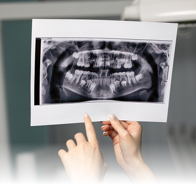 Hands hold a dental X-ray image showing a detailed view of teeth and jaw structure. The background is blurred, focusing attention on the X-ray.
